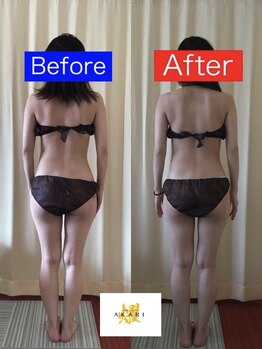 エナジーサロン アカリ(燿)/ハイパー集中コース(裏側)