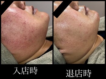 ビーエルティー(blt)/レモンボトル