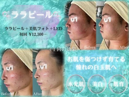 ウイ(u'i)の写真