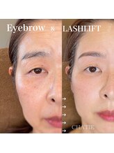 チャティー(CHATIE)/