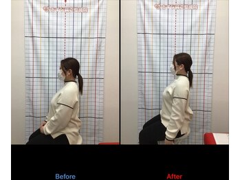 きずな鍼灸整骨院 光の森院/姿勢の悪さからくる肩こり