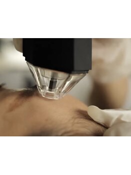 シミしわ改善！予防ケア