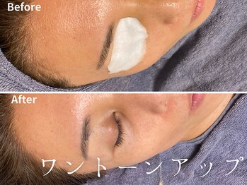 グレース 吉祥寺(grace)/くすみ改善 吉祥寺 フェイシャル