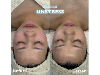 リリーラボ(LILY LAB)/【UNSTRESS/アンストレス】