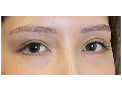 エンドアイ(&i)の写真