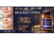 アヴァンサル 札幌駅前店(Avanzar)の雰囲気（リジュ/PDRNの最新韓国肌管理★完全都度払いで安心！）