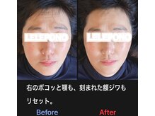 美容矯正サロン レレポノ(LELEPONO)/