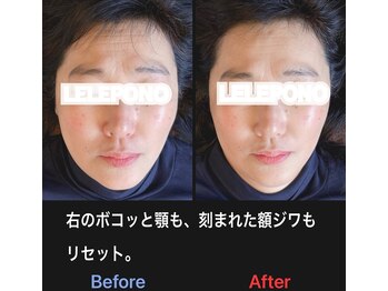 美容矯正サロン レレポノ(LELEPONO)/