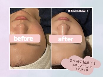 オプス ライフビューティー(OPS×LIFE BEAUTY)/理想のカタチへ