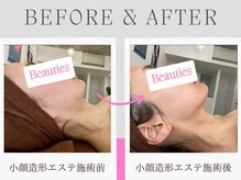 ビューティーズ(Beauties)の雰囲気（小顔造形エステは、当日はもちろん約2週間後に特に効果を実感◎）