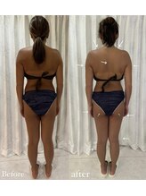 ミミルーチェ(mimiluce)/後ろ姿も別人！反り腰改善