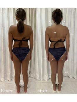 ミミルーチェ(mimiluce)/後ろ姿も別人！反り腰改善