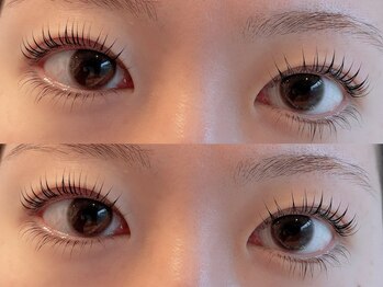 ユーロ(EURO)/上下ラッシュリフト