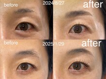 ネージュ(Neige)の雰囲気（通えば通うほどナチュラル眉に！まつ毛もより長く！！）