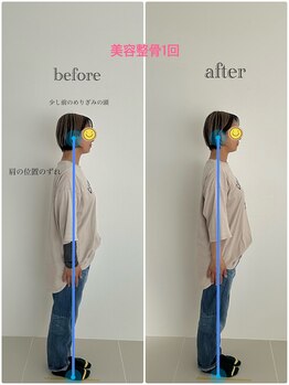 イト(ito)/美容整骨