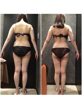 フローボディ 新山口店(flow BODY)/山口のエステはflow BODY