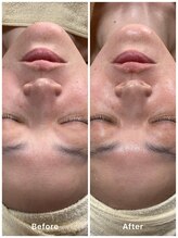 ゆりの花/オールハンドフェイシャル70分