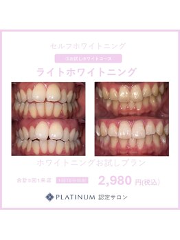 オリジン 大分王子店(origin)/大分ホワイトニング