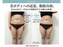 エタンセル(Etincelle)/