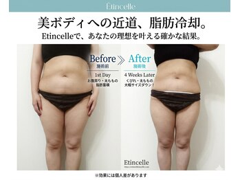 エタンセル(Etincelle)/