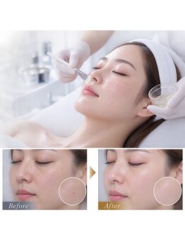 ドルチェビューティーサロン 戸塚安行店(Dolce Beauty Salon)の写真/【エイジングケア◎】次世代ピーリングと美容機器でシミ・たるみ・ほうれい線などのエイジング悩みを改善！