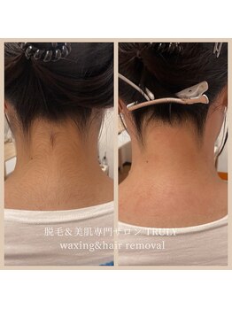 トゥルーリー(TRULY)/《うなじワックス》