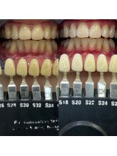 トウキョウスワーズ 池袋店(TOKYO SWRS)/#ホワイトニング #池袋 #渋谷
