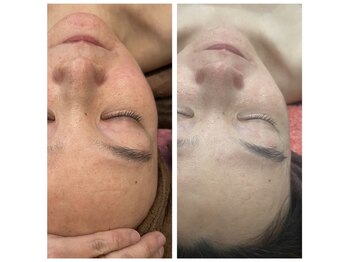 ココ 茅ヶ崎店(Coco)/お悩みに合わせてご提案