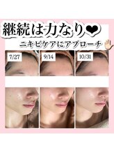 ホワイトアクア 新宿本店(WHITE AQUA)/ララピール/東京/新宿