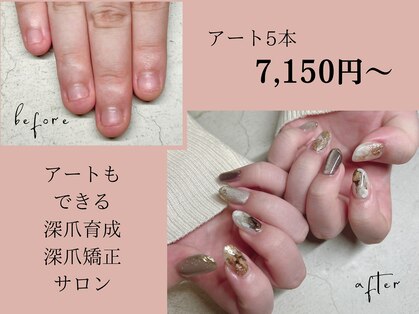 ユユネイル(yuyu nail)の写真