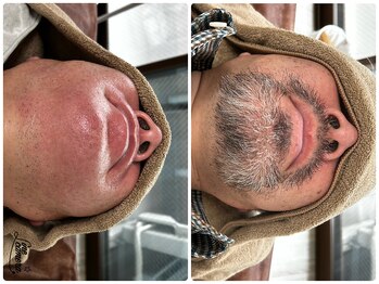 サロンエム 西荻窪(salon M)/ひげワックス