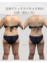 アメリオ(Amelio)/全身デトックス＋キャビ90分