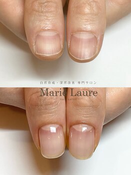 マリーロール 淀屋橋本店(Marie Laure)/深爪矯正/自爪育成/ネイルケア