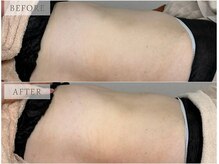 サロン ド ブラン アオヤマ(Salon de BLANC AOYAMA)/腸もみマッサージ/オプション