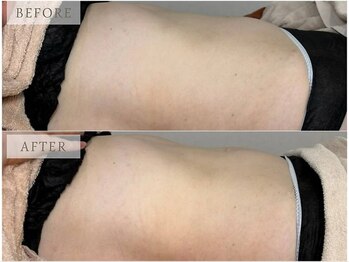 サロン ド ブラン アオヤマ(Salon de BLANC AOYAMA)/腸もみマッサージ/オプション