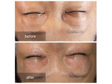 老廃物や眼精疲労がスッキリ♪【目元専門エステ】