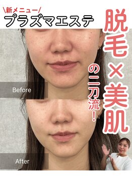 エムアンドエム(M&M)/