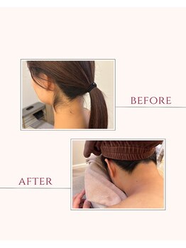 レ サロン(les SALON)/脱毛で美意識UP♪