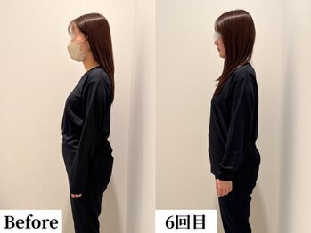 ソレア(Solea)/反り腰改善 6回目