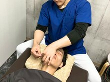 わいわい柳川院/美肌と小顔へ導く顔鍼灸