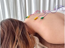 リリアン(Riliane)の雰囲気（肩こり、首コリに《はりきゅう》おすすめです！）