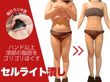 セルライト専門店【癒しゼロの熱血エステ】FEMBE錦糸町店【7/1　NEW OPEN（予定）】の雰囲気（【お腹/上半身】運動-食事制限で落ちないぽっこりお腹もスッキリ）