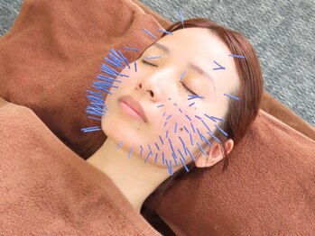はまの整骨鍼灸院の写真/【圧倒的な知識量×技術で違いを実感！】こだわり抜いた施術で妥協は一切なし！お肌のバリア機能を向上◎