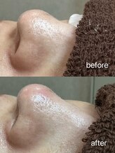 エクラ バイ シャンリィ(eclat by shanLy)/すっぴんキレイに！