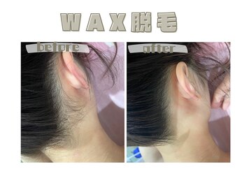 レヴィート(Revept)/【ワックス脱毛】