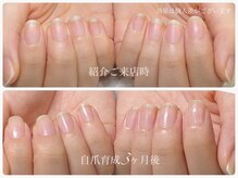 アウラ ネイル ファクトリー(aura nail factory)/最強のネイルケア自爪育成☆赤羽