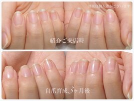 最強のネイルケア自爪育成☆赤羽