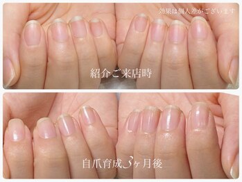 アウラ ネイル ファクトリー(aura nail factory)/最強のネイルケア自爪育成☆赤羽
