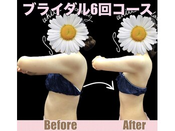 スワン 新栄店(SWAN)/結果重視★ブライダルエステ