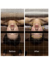 レグラージュ(Reglage)/艶肌＆小顔　Before＆After